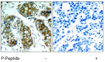 Immunohistochemistry (Formalin/PFA-fixed paraffin-embedded sections) - Anti-Cdc25A (phospho S76) antibody (AB75743)