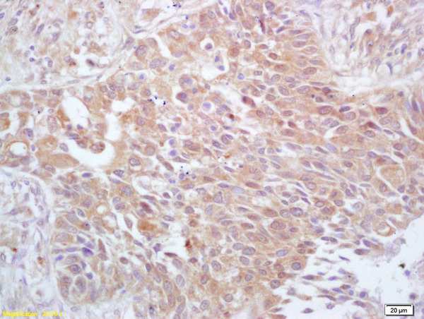 Immunohistochemistry (Formalin/PFA-fixed paraffin-embedded sections) - Anti-Cdc25A (phospho T507) antibody (AB203618)