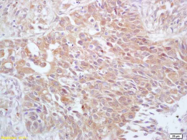 Immunohistochemistry (Formalin/PFA-fixed paraffin-embedded sections) - Anti-Cdc25A (phospho T507) antibody (AB203618)