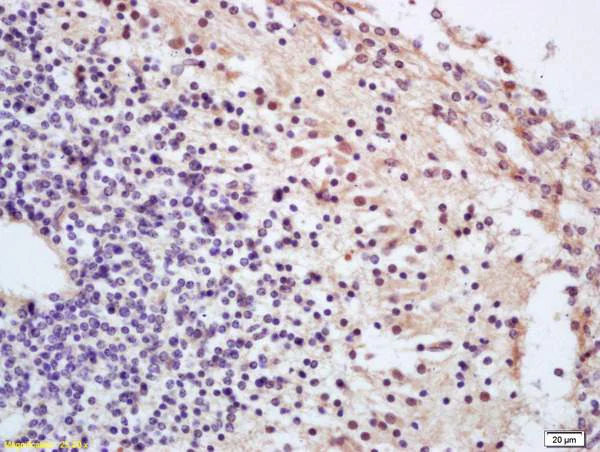 Immunohistochemistry (Formalin/PFA-fixed paraffin-embedded sections) - Anti-Cdc25A (phospho T507) antibody (AB203618)