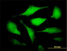 Immunocytochemistry/ Immunofluorescence - Anti-Cdc25B antibody (AB167347)
