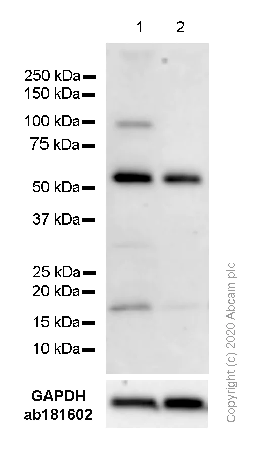 Western blot - Anti-Cdc25B antibody [EPR3459(2)] - BSA and Azide free (AB248020)