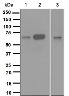 Western blot - Anti-Cdc25B antibody [EPR3459(2)] - BSA and Azide free (AB248020)