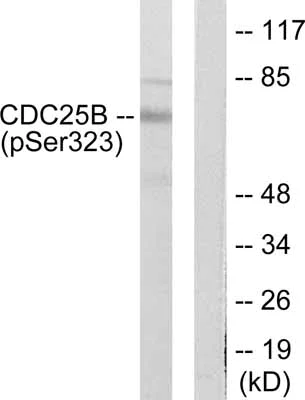 Western blot - Anti-Cdc25B (phospho S323) antibody (AB53103)