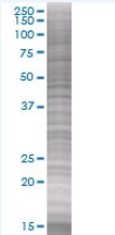 SDS-PAGE - Cdc25C overexpression 293T lysate (whole cell) (AB94219), expandable thumbnail