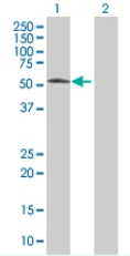 Western blot - Cdc25C overexpression 293T lysate (whole cell) (AB94219), expandable thumbnail