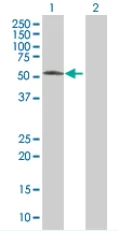 Western blot - Cdc25C overexpression 293T lysate (whole cell) (AB94219)