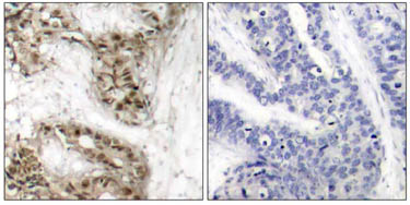 Immunohistochemistry (Formalin/PFA-fixed paraffin-embedded sections) - Anti-Cdc25C (phospho S216) antibody (AB47322)