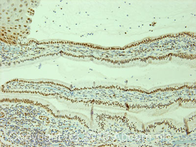 Immunohistochemistry (Formalin/PFA-fixed paraffin-embedded sections) - Anti-Cdc27 antibody [AF3.1] (AB10538)