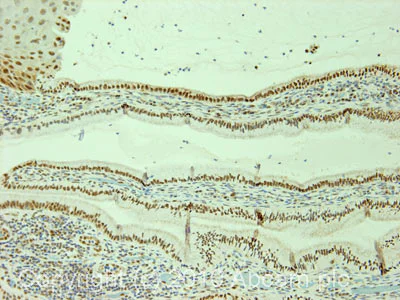 Immunohistochemistry (Formalin/PFA-fixed paraffin-embedded sections) - Anti-Cdc27 antibody [AF3.1] (AB10538)