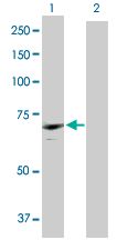 Western blot - Anti-CDC2L6 antibody (AB168633)