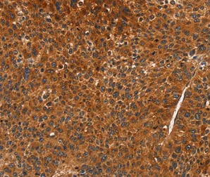 Immunohistochemistry (Formalin/PFA-fixed paraffin-embedded sections) - Anti-CDC2L6 antibody - N-terminal (AB198843)