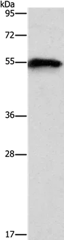 Western blot - Anti-CDC2L6 antibody - N-terminal (AB198843)
