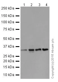 Western blot - Anti-Cdc34 antibody [EPR16808] - BSA and Azide free (AB251415)