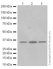 Western blot - Anti-Cdc34 antibody [EPR16808] - BSA and Azide free (AB251415)