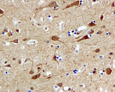 Immunohistochemistry (Formalin/PFA-fixed paraffin-embedded sections) - Anti-Cdc37 antibody [EPR4935] - BSA and Azide free (AB226022)