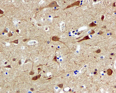 Immunohistochemistry (Formalin/PFA-fixed paraffin-embedded sections) - Anti-Cdc37 antibody [EPR4935] - BSA and Azide free (AB226022)