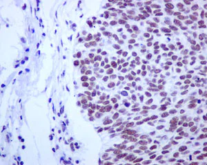 Immunohistochemistry (Formalin/PFA-fixed paraffin-embedded sections) - Anti-CDC40 antibody [EPR12539] (AB175924)