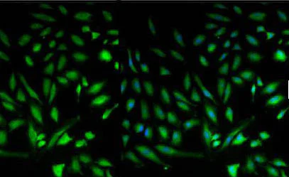 Immunocytochemistry/ Immunofluorescence - Anti-CDC42 antibody (AB155940)