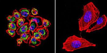 Immunocytochemistry/ Immunofluorescence - Anti-CDC42 antibody (AB155940)