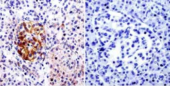 Immunohistochemistry (Formalin/PFA-fixed paraffin-embedded sections) - Anti-CDC42 antibody (AB155940)