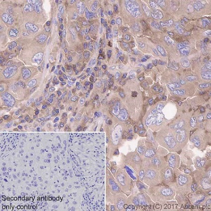 Immunohistochemistry (Formalin/PFA-fixed paraffin-embedded sections) - Anti-CDC42 antibody [EPR15620] - BSA and Azide free (AB271953), expandable thumbnail