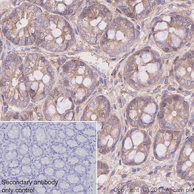 Immunohistochemistry (Formalin/PFA-fixed paraffin-embedded sections) - Anti-CDC42 antibody [EPR15620] - BSA and Azide free (AB271953), expandable thumbnail