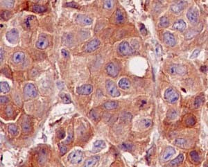 Immunohistochemistry (Formalin/PFA-fixed paraffin-embedded sections) - Anti-CDC42 antibody [EPR15620] - BSA and Azide free (AB271953), expandable thumbnail