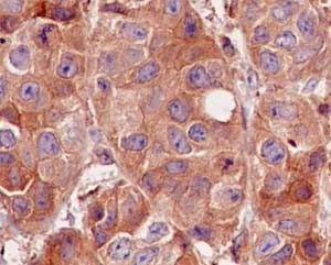 Immunohistochemistry (Formalin/PFA-fixed paraffin-embedded sections) - Anti-CDC42 antibody [EPR15620] - BSA and Azide free (AB271953)