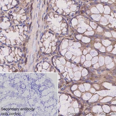 Immunohistochemistry (Formalin/PFA-fixed paraffin-embedded sections) - Anti-CDC42 antibody [EPR15620] - BSA and Azide free (AB271953), expandable thumbnail