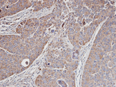 Immunohistochemistry (Formalin/PFA-fixed paraffin-embedded sections) - Anti-CDC42 binding protein kinase alpha antibody (AB96659), expandable thumbnail