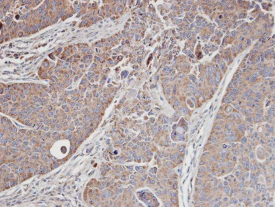 Immunohistochemistry (Formalin/PFA-fixed paraffin-embedded sections) - Anti-CDC42 binding protein kinase alpha antibody (AB96659)