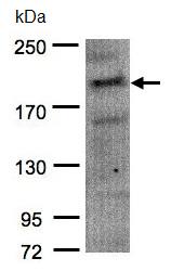 Western blot - Anti-CDC42 binding protein kinase alpha antibody (AB96659), expandable thumbnail