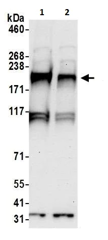 Western blot - Anti-CDC42 Binding Protein Kinase Beta antibody (AB226345)