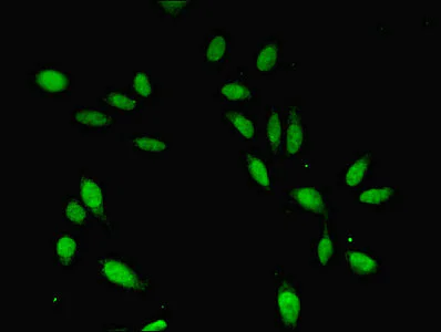 Immunocytochemistry/ Immunofluorescence - Anti-CDC45L antibody (AB230178)