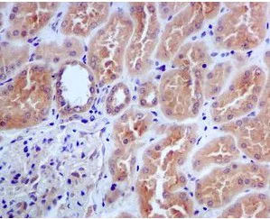 Immunohistochemistry (Formalin/PFA-fixed paraffin-embedded sections) - Anti-CDC45L antibody [EPR5758] (AB108350)