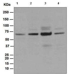 Western blot - Anti-CDC45L antibody [EPR5758] (AB108350), expandable thumbnail