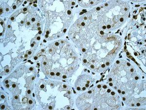 Immunohistochemistry (Formalin/PFA-fixed paraffin-embedded sections) - Anti-CDC5L antibody [EPR7658] (AB129114), expandable thumbnail