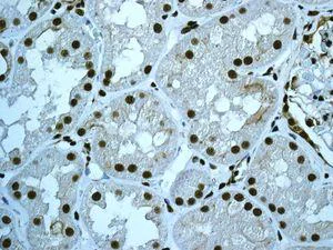 Immunohistochemistry (Formalin/PFA-fixed paraffin-embedded sections) - Anti-CDC5L antibody [EPR7658] (AB129114)