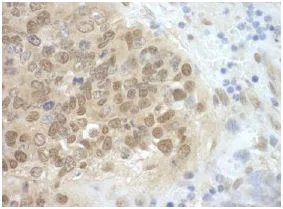 Immunohistochemistry (Formalin/PFA-fixed paraffin-embedded sections) - Anti-Cdc6 antibody (AB125195)