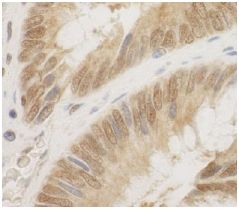 Immunohistochemistry (Formalin/PFA-fixed paraffin-embedded sections) - Anti-Cdc6 antibody (AB125195)