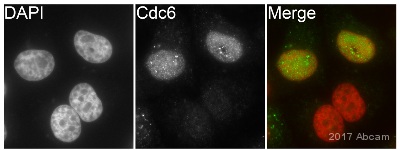 Immunocytochemistry/ Immunofluorescence - Anti-Cdc6 antibody [EPR714(2)] (ab109315), expandable thumbnail
