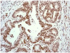 Immunohistochemistry (Formalin/PFA-fixed paraffin-embedded sections) - Anti-Cdc6 antibody [EPR714(2)] (AB109315)
