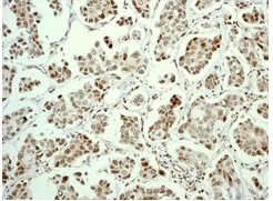 Immunohistochemistry (Formalin/PFA-fixed paraffin-embedded sections) - Anti-Cdc6 antibody [EPR714(2)] (AB109315)