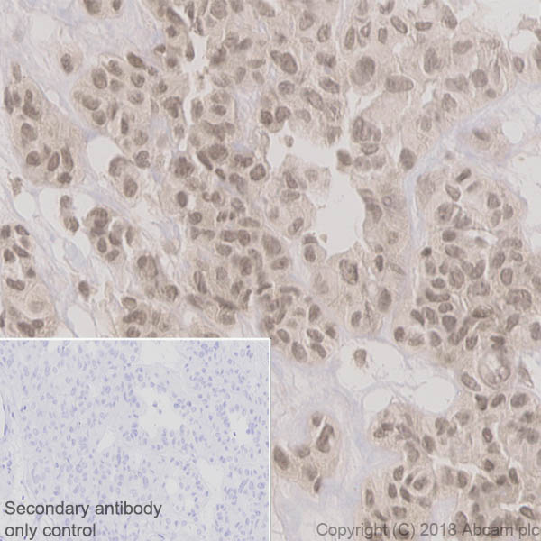 Immunohistochemistry (Formalin/PFA-fixed paraffin-embedded sections) - Anti-Cdc6 antibody [EPR714(2)] (AB109315), expandable thumbnail