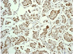 Immunohistochemistry (Formalin/PFA-fixed paraffin-embedded sections) - Anti-Cdc6 antibody [EPR714(2)] - BSA and Azide free (AB211734)