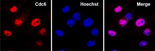 Immunocytochemistry/ Immunofluorescence - Anti-Cdc6 antibody - N-terminal (AB188423), expandable thumbnail