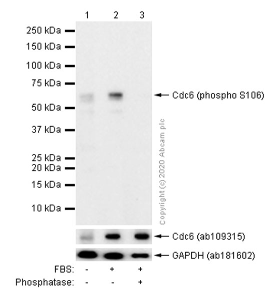 Western blot - Anti-Cdc6 (phospho S106) antibody [EPR761(2)] (AB76422), expandable thumbnail