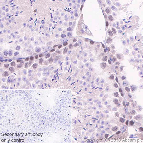 Immunohistochemistry (Formalin/PFA-fixed paraffin-embedded sections) - Anti-CDC7 antibody [EPR20337] (AB229187)