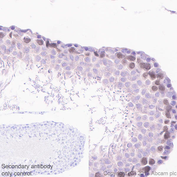 Immunohistochemistry (Formalin/PFA-fixed paraffin-embedded sections) - Anti-CDC7 antibody [EPR20337] (AB229187)